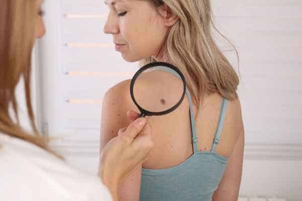 What Are Traditional Skin Lesion Removal Methods Whitstable?
