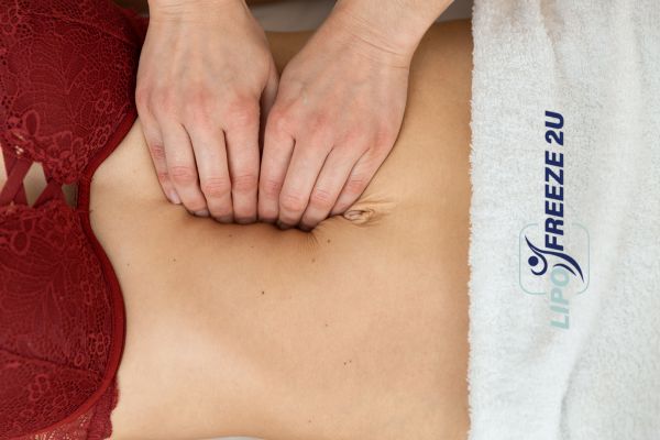 diastasis recti treatment Whitstable