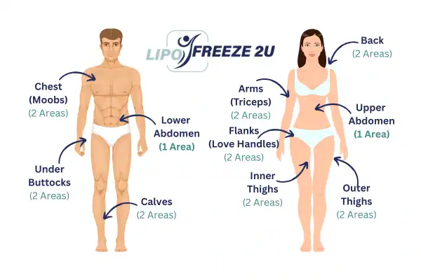 Areas you can have fat freezing treatment Whitstable