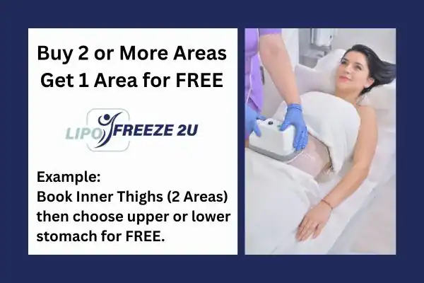 fat freezing prices Whitstable