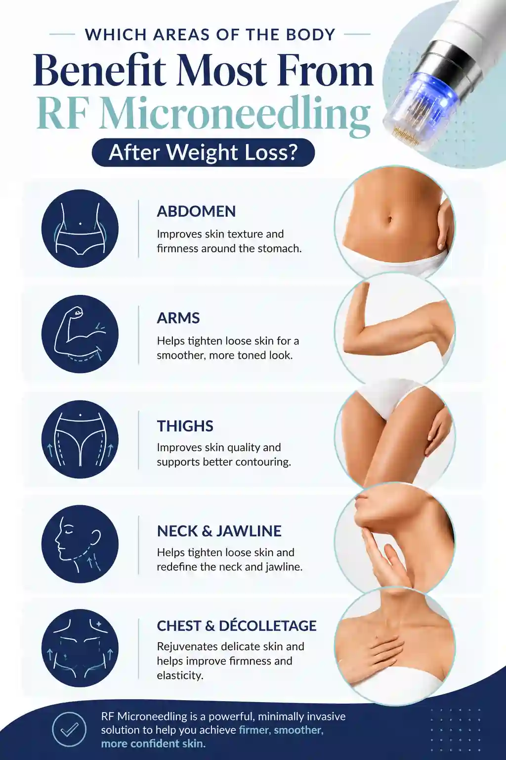 Which Areas of the Body Benefit Most From RF Microneedling After Weight Loss Whitstable